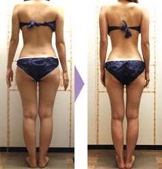 N様 23歳/会社員